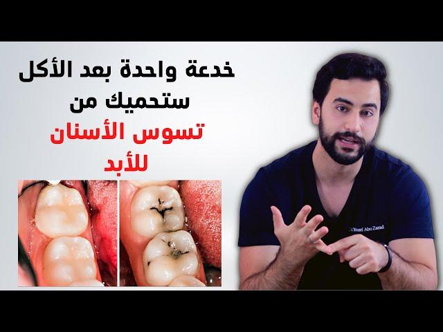 خدعة بعد الأكل ستحميك من تسوس الأسنان للأبد