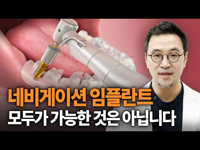 네비게이션 임플란트와 일반 임플란트의 차이점