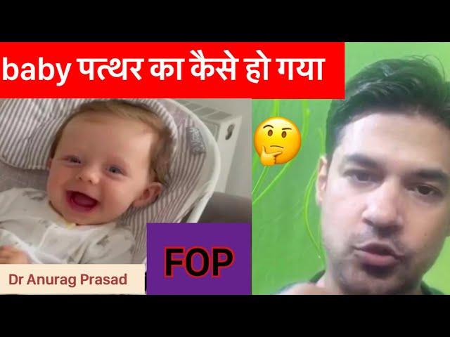 Stone Baby | Fibrodysplasia Ossificans Progressiva (fop) | Dr Anurag Prasad