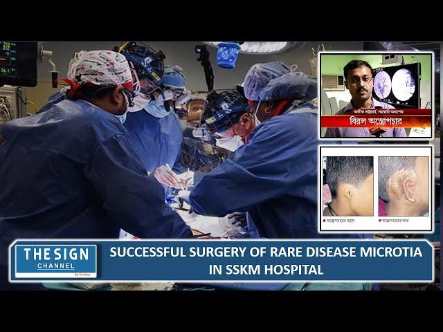 Successful surgery of rare disease microtia in SSKM hospital