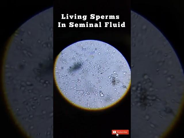 Human Sperm in Living Stage #biology #zoology #viralvideo #neet #viralshorts #neet #bsc