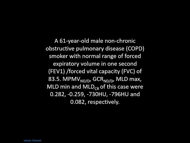 Smoking and airflow limitation in smokers and COPD patients - Supplementary video 2 [ID 389075]