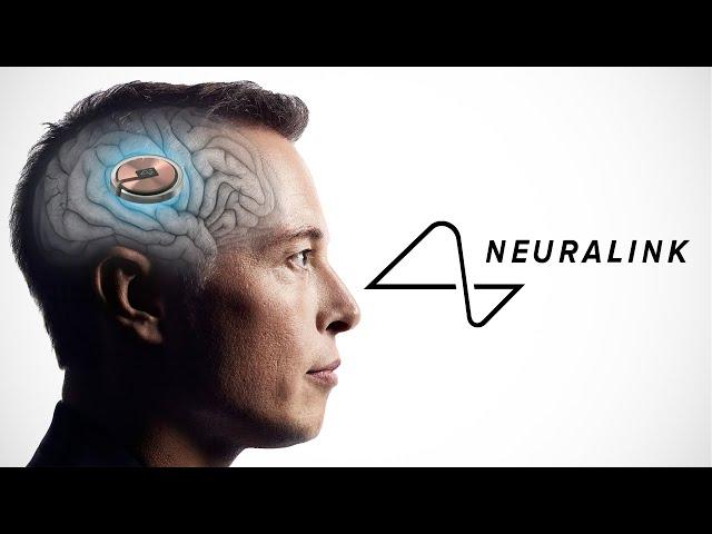 Elon Musk's Neuralink Scares Me