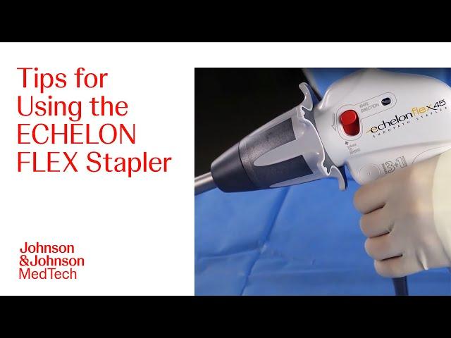 Step-by-Step Tutorial to Laparoscopic Tissue Stapling with the ECHELON FLEX Stapler | J&J MedTech