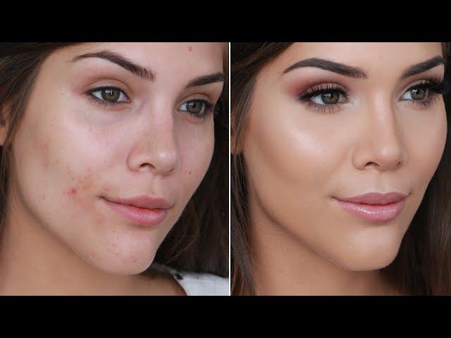 How to Cover Acne and Pimples With Makeup! | Katerina Williams