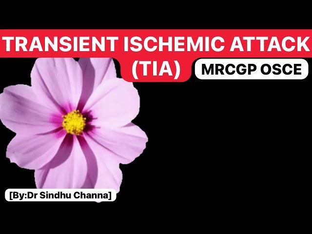 Transient Ischemic Attack (TIA) - MRCGP OSCE