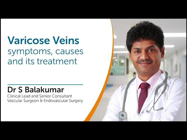 Varicose Veins - Symptoms,Causes and Treatments Explained By Dr S Balakumar - Vascular Surgeon