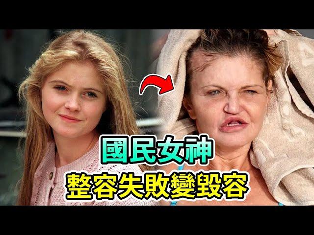 英國女星整容失敗全臉毀容！鼻子塌陷一只眼失明，嚇跑小男友！50歲面目全非星途全毀 #DanniellaWestbrook #Boogie島