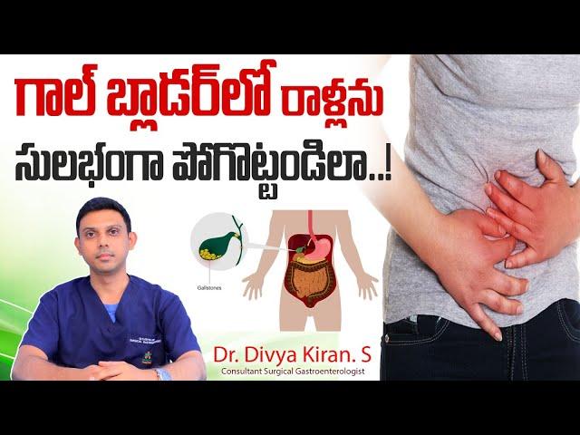 పిత్తాశయంలో రాళ్లు | Symptoms of Gallbladder Stones | Gallstones Treatment Telugu | Renova Hospitals