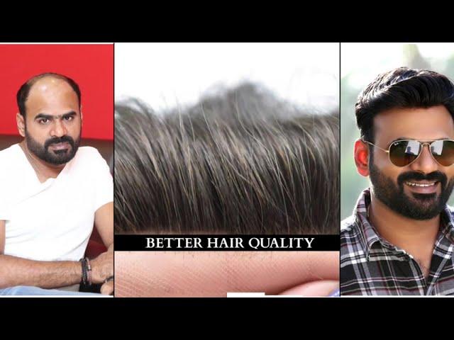 Hair Patch service | Natural Looking Hair | | Non-Surgical Hair Replacement