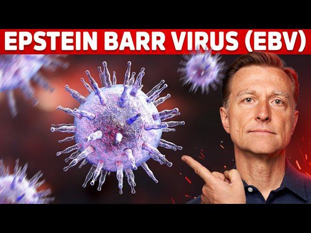 The 5 Things You MUST Know about Epstein-Barr Virus (EBV)