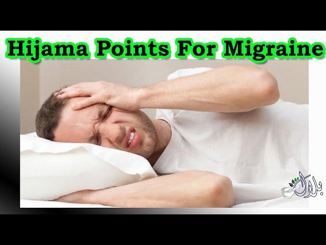 HIjama Points For Migraine