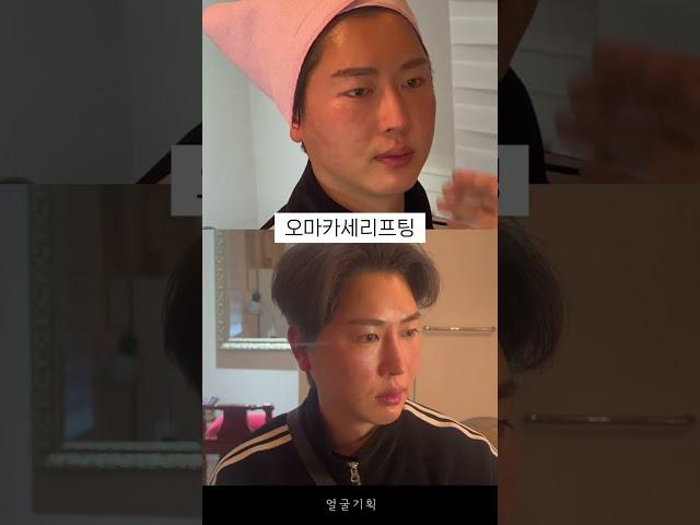 [얼굴기획] 날렵한 턱라인 팔자주름 필러없이 채우는 방법 #shorts