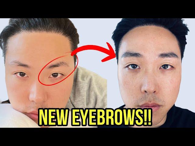 4 REASONS WHY I DIDN’T GET AN EYEBROW HAIR TRANSPLANT!