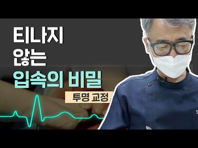티 나지 않는 입속의 비밀 (이루미치과 / 전영진 원장 / 051-816-8980)