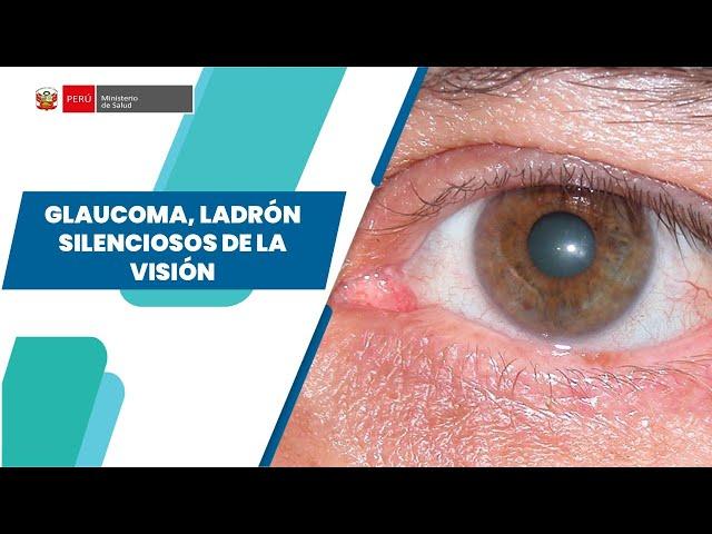 GLAUCOMA, LADRÓN SILENCIOSOS DE LA VISIÓN