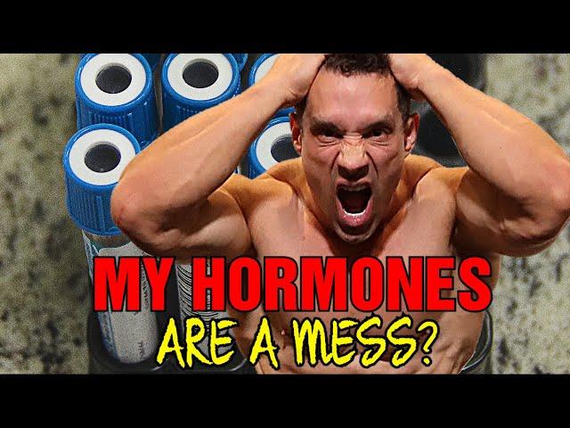 My Hormones Are A Mess? || Detailed Bloodwork Analysis With Marek Health