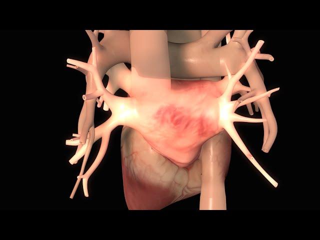 Effects of Congestive Heart Failure