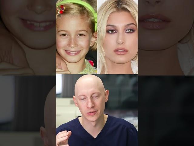 Hailey Bieber had a Nose Job? Plastic Surgeon Reacts