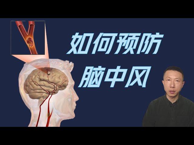 How to Prevent Stroke (Cerebrovascular Accident)