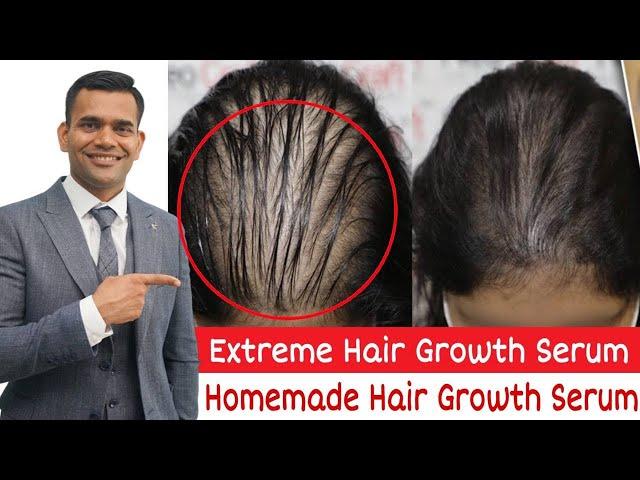 DIY Extreme Hair Growth Serum | Powerful Homemade Serum For extreme Hair Growth