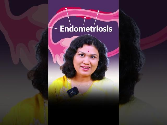 Endometriosis को कंट्रोल करने के Natural Tips और Fertility Diet! #shorts #prernasfertilitycare