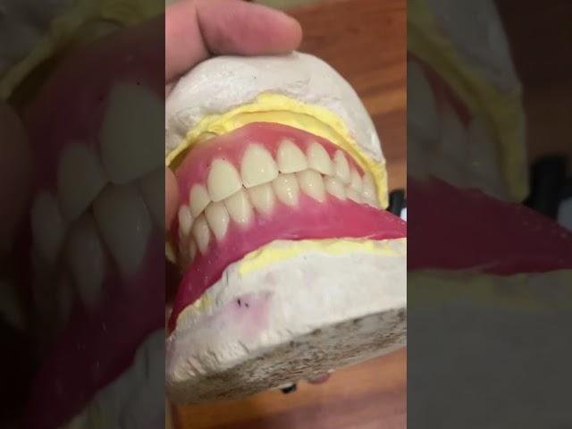 Denture setup #umairtoothfairy #dentist #dentalcrowns #denture #viral #shorts @Umairazeem8553