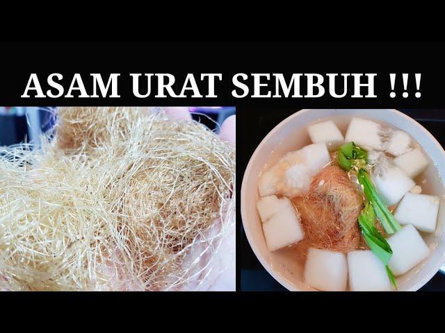 ASAM URAT SEMBUH DENGAN BAHAN YANG SELAMA INI KITA BUANG. NATURAL REMEDIES TREATMENTS FOR GOUT