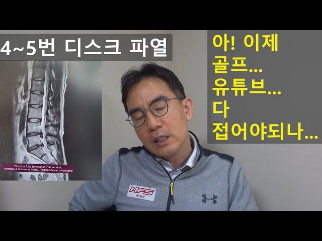 조프로 허리디스크 파열... 아! 이제 골프 못하나...