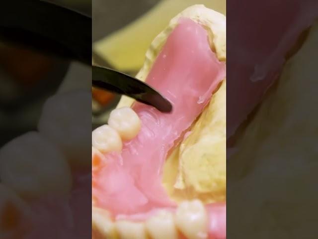 How dentures are made. #dentures #teeth #prosthodontist #casting #Insider