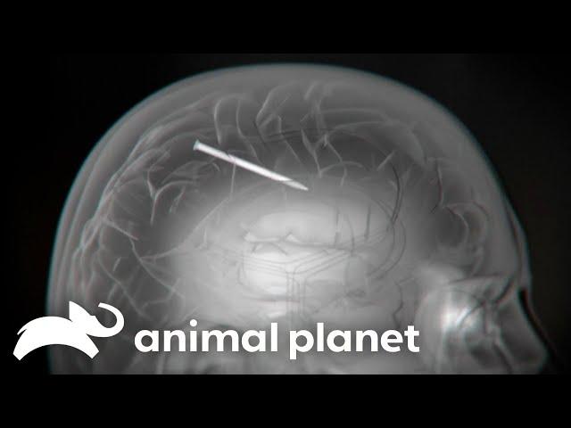 A Man Has A Whole Nail Stuck In His Brain! | Monsters Inside Me | Animal Planet