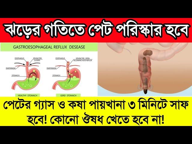 গ্যাসের জন্য আর কখনো মেডিসিন খেতে হবে না|| পেটের গ্যাস ও কষা পায়খানা ৩ মিনিটে দূর হবে শুধু এটি খেলেই