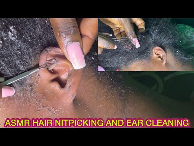 ASMR EAR CLEANING AND HAIR NITPICKING FOR THOSE WHO WANT SLEEP WITH GUM CHEWING AND WHISPERING.