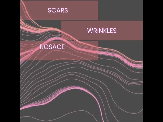 Skin Resurfacing with Venus Viva™ MD