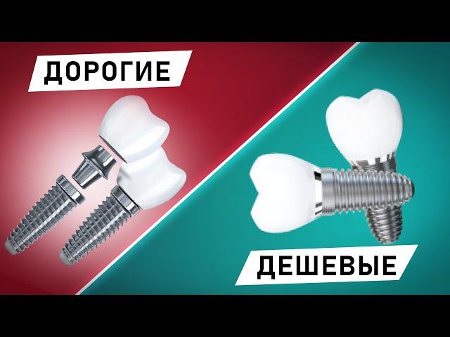 Дорогие и дешевые импланты: в чем разница? Стоит ли переплачивать?