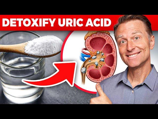 The Ultimate Kidney Cleanse for Uric Acid and Gout: Dr. Berg's Proven Techniques