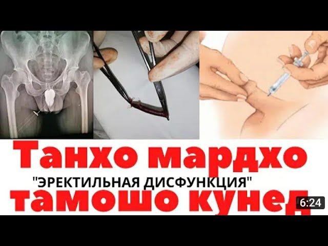 МАРДОНАГИ НАМЕХЕЗАД  ЧИКОР БОЯД КАРД