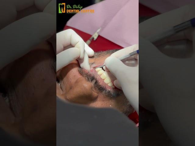 Experience the Magic of Smile Designing with | Dr. Dilipkumar