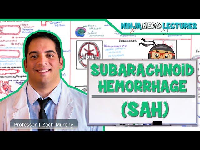 Subarachnoid Hemorrhage | Etiology, Pathophysiology, Clinical Features, Treatment, Complications