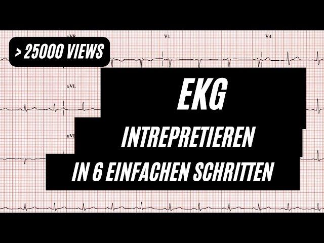 EKG interpretieren in 6 Schritten