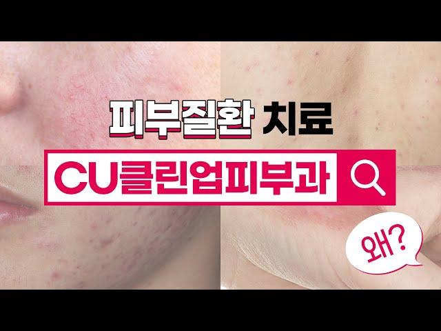 피부질환치료는 피부과 전문의에게! – 당신의 평생 피부 주치의 CU클린업피부과