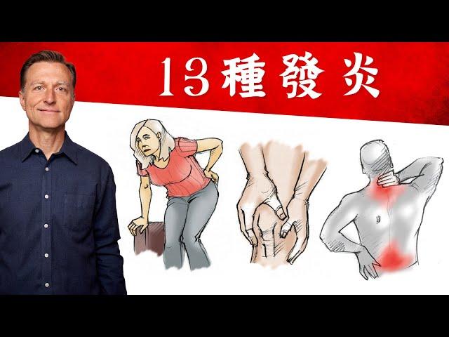 13種發炎,消炎自然療法,柏格醫生 Dr Berg