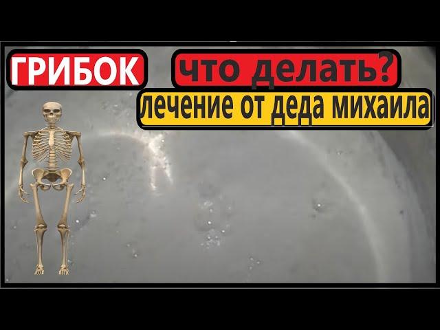 ОТ  ГРИБКА НОГТЕЙ Мощнейший Рецепт Деда Михаила - 200%.
