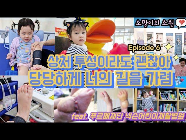 Epi. 6 | The Story of Noelle’s Second Rehabilitation Stay | Purme Nexon Children’s Rehab Hospital
