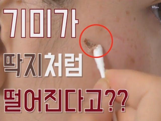 [그녀의 살림창고] 기미가 뚝 떨어지네?? 기미딱지 패치