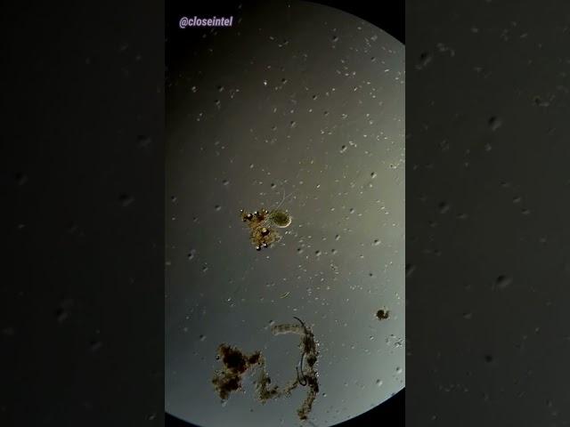 Cell Explodes Under Microscope (Hydrogen Peroxide vs Germs)