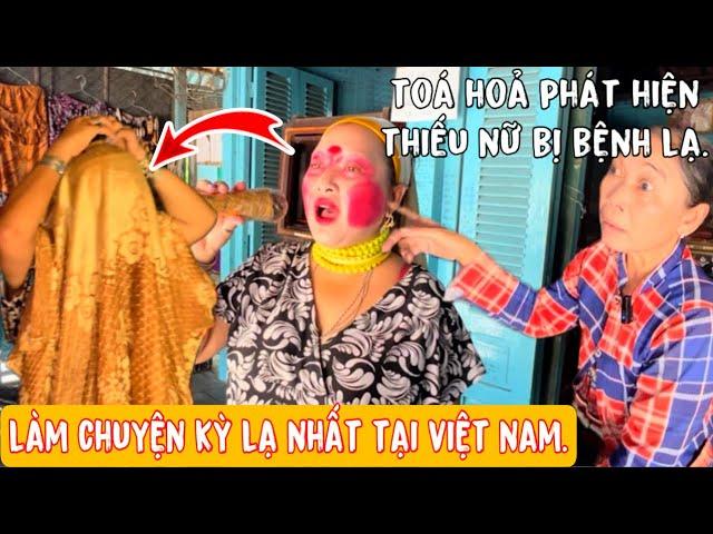 Toá Hoả Phát Hiện"Thiếu Nữ"Bị Căn Bệnh lạ Làm Chuyện Khó Hiểu Nhất Tại Việt Nam.sợi quá