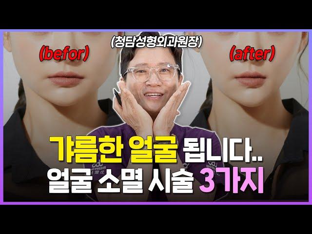 얼굴 작아지는 법(V라인) ※이걸로 종결※ 전문의가 알려주는 확실한 시술 추천 3가지!!