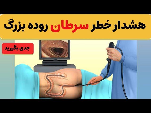 مراقب باشید!  این علائم، نشانه های زودرس و نهفته سرطان روده بزرگ هست