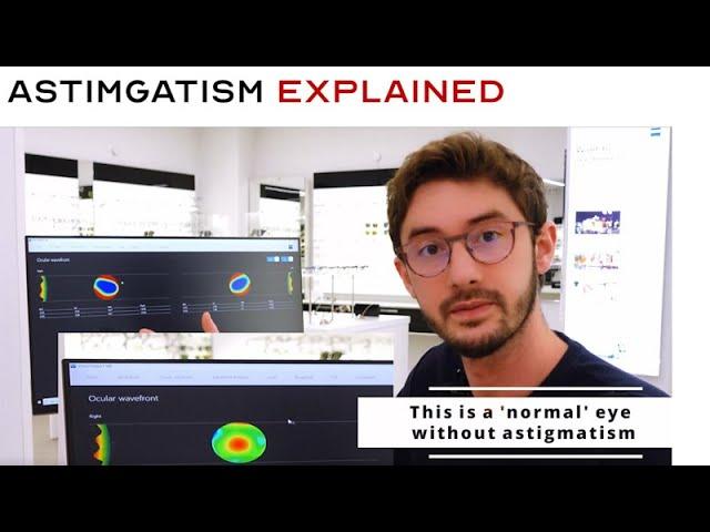 What is Astigmatism? The ONLY Video You Need to Watch | What is CYL? | Your Prescription Explained